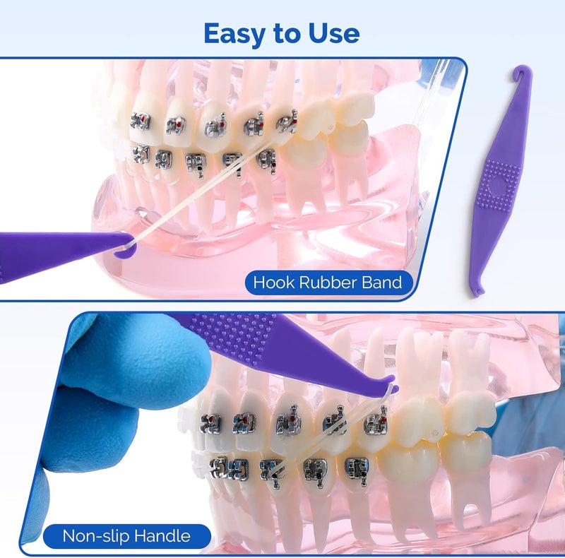 JMU Orthodontic Elastics 1/4 Light 100 Pack Intraoral Elastic Bands Latex Dental Rubber Bands Made in USA - Image 5